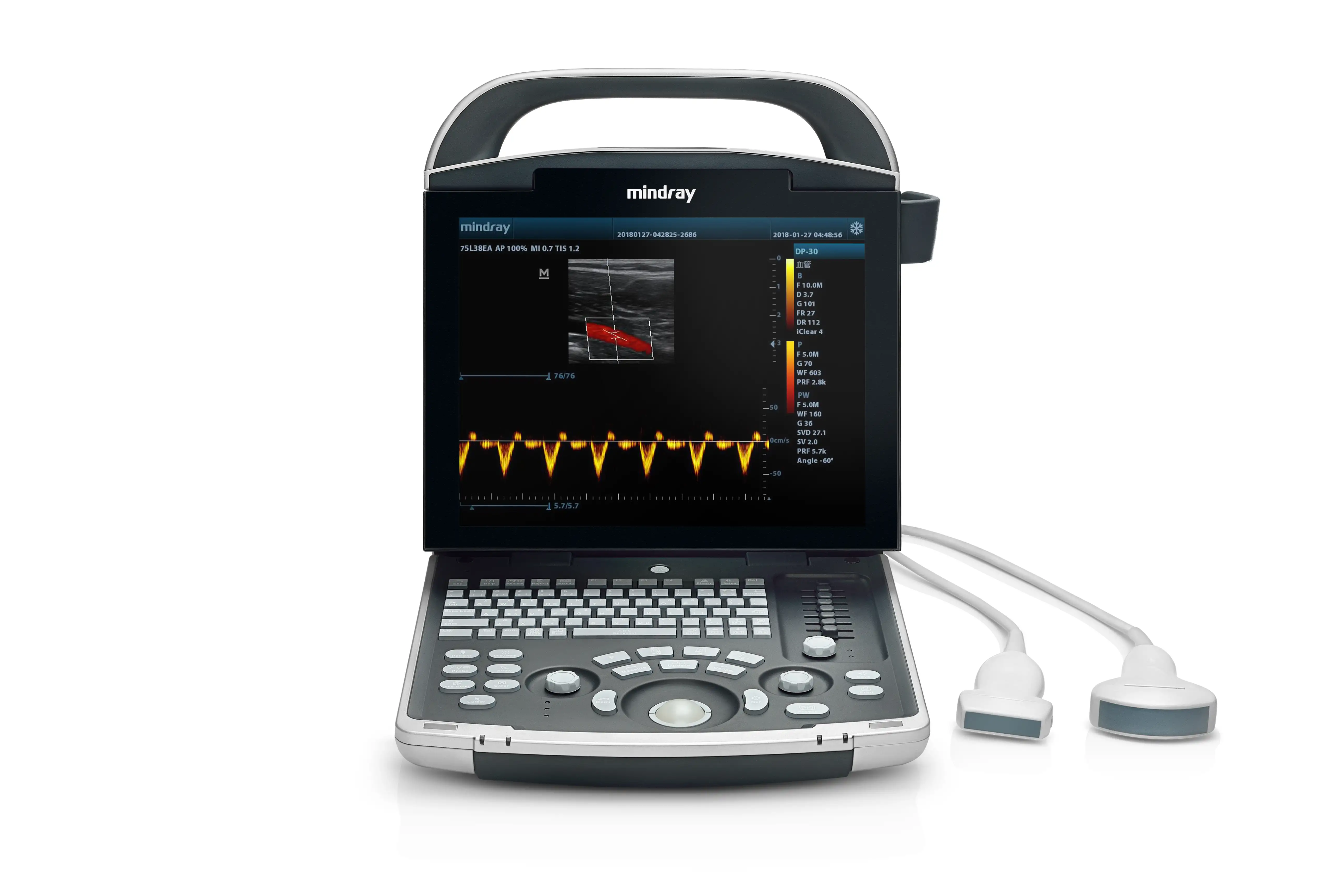 Система ультразвукова діагностична Mindray DP-30