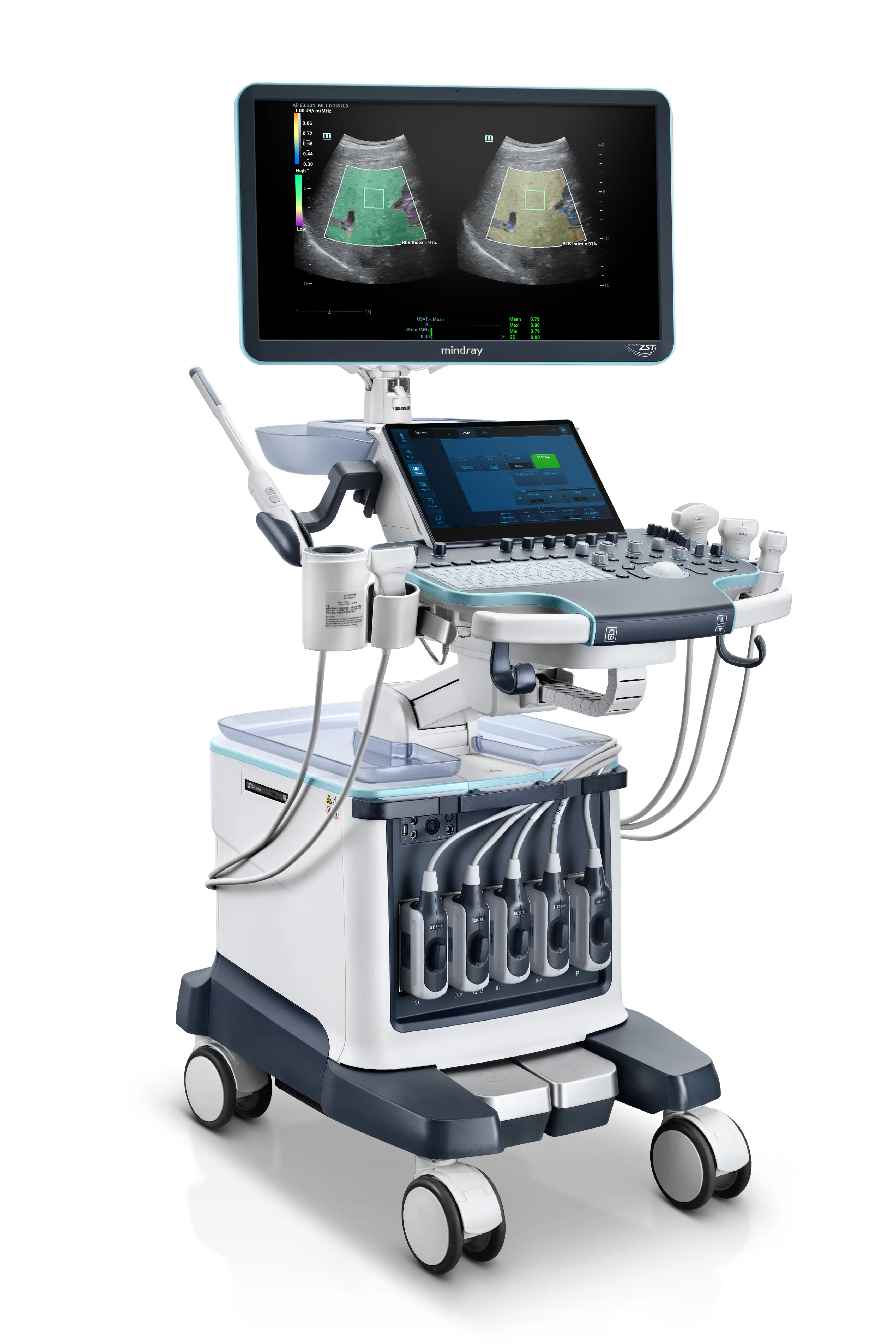 Система ультразвукова діагностична Resona R9  Platinum Edition