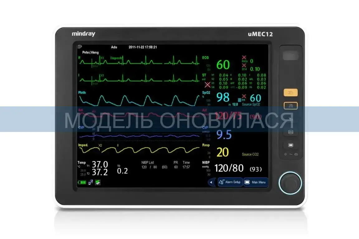 Mindray uMEC12 patient monitor