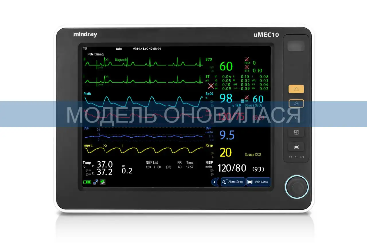 Монітор пацієнта Mindray uMEC10