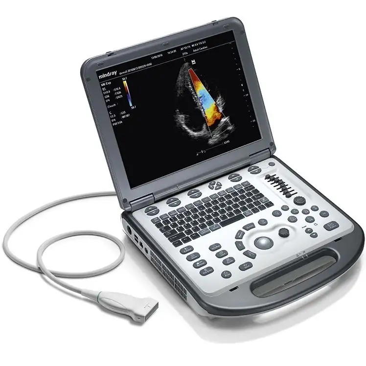 Ultrasonic diagnostic system M6